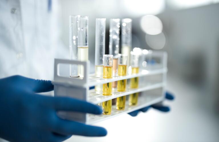 Close up of CBD oil in test tubes at laboratory.