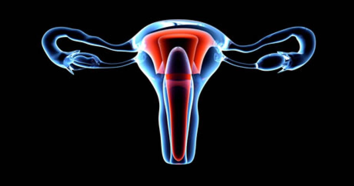 ovarian
