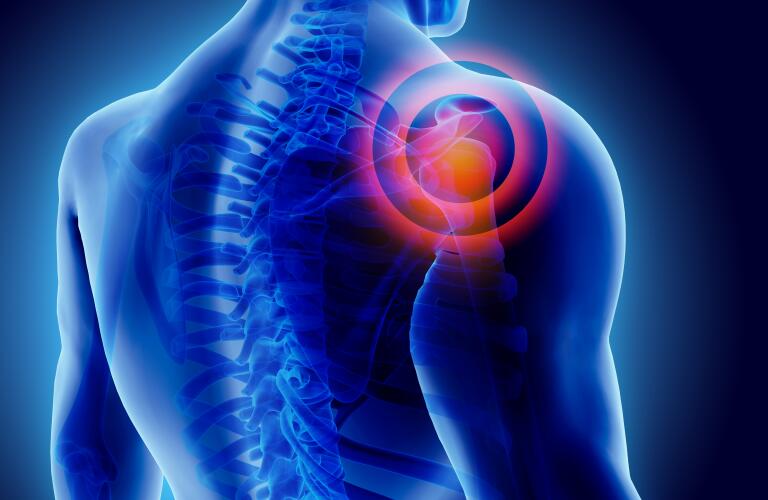 3D shoulder illustration with pain