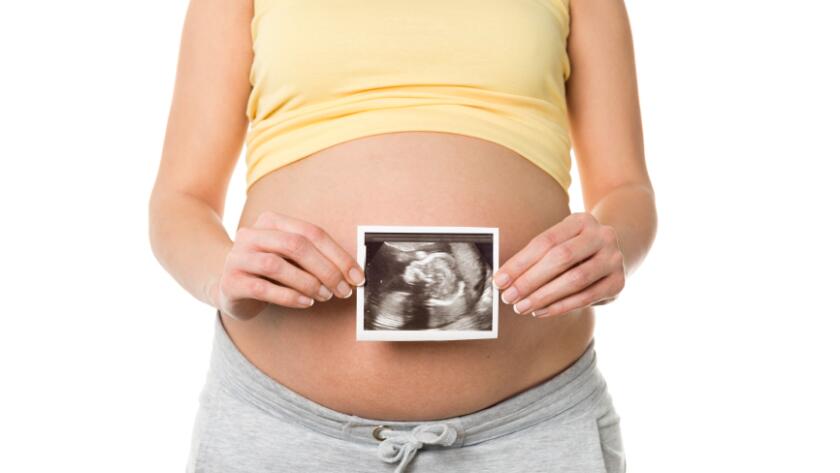 Pregnant woman showing ultrasound picture