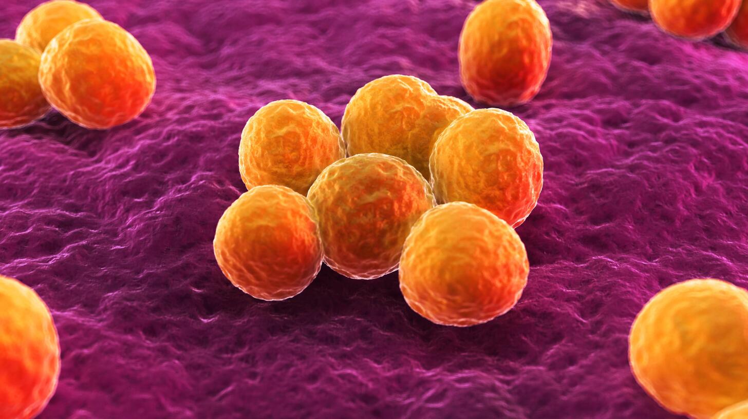 What Is MRSA & Is It Contagious? MRSA Infection Symptoms & Treatment