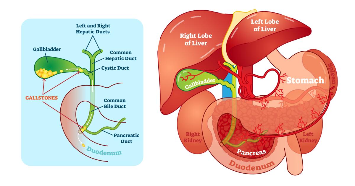 bile-duct-obstruction-symptoms-causes-treatments