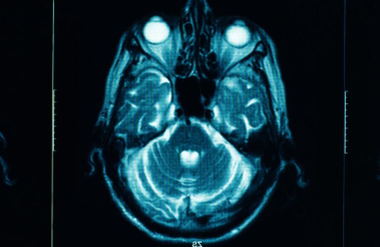 brain scan