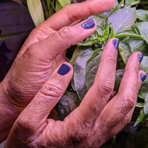 Handwashing Inflamed My Eczema Here’s What I’m Doing to Repair My Hands