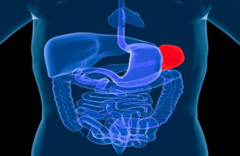 Splenectomy