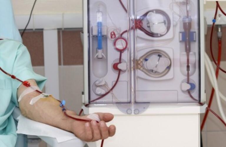 Arteriovenous (AV) Fistula Surgery - AV Fistula Surgery Arteriovenous (AV) Fistula Surgery - AV Fistula Surgery