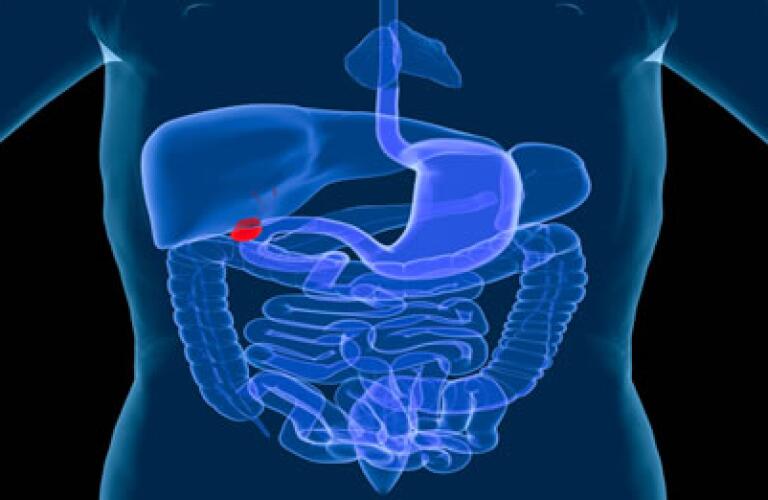 A Client With Calculi In The Gallbladder Is Said To Have - slidesharetrick A Client With Calculi In The Gallbladder Is Said To Have - slidesharetrick