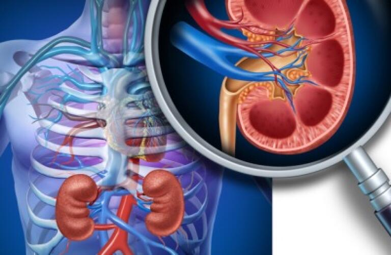 Nephrectomy - 460x261