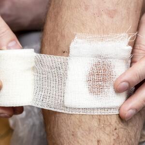 Mrsa Symptoms 6 Early Warning Signs Of Mrsa