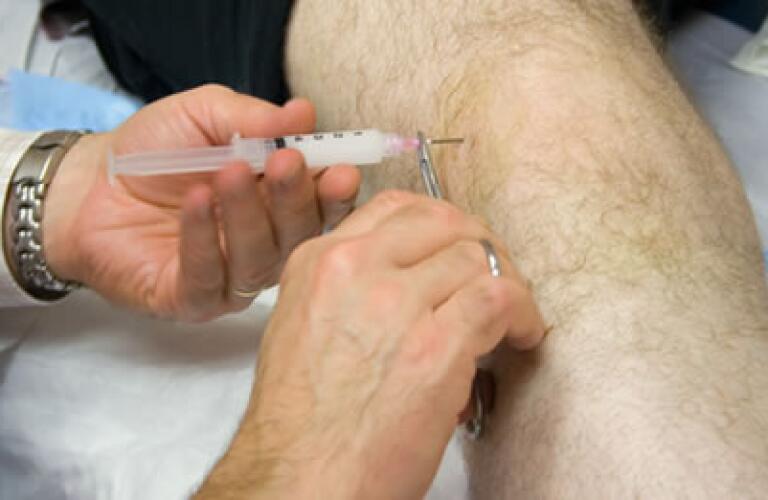 Arthrocentesis