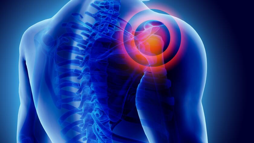 3D shoulder illustration with pain
