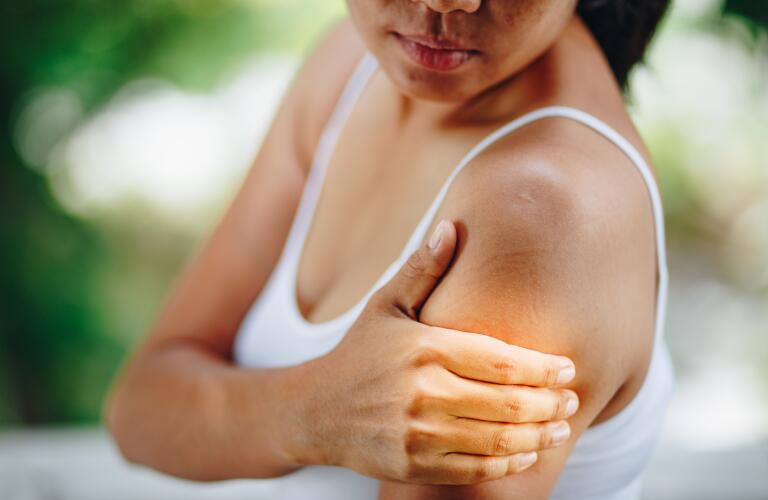Treating Hives Hives Information