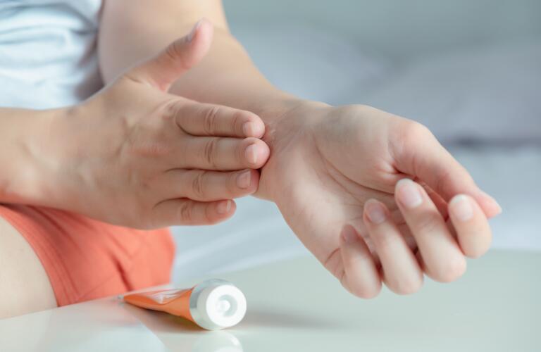 woman applying medicated gel to her wrist