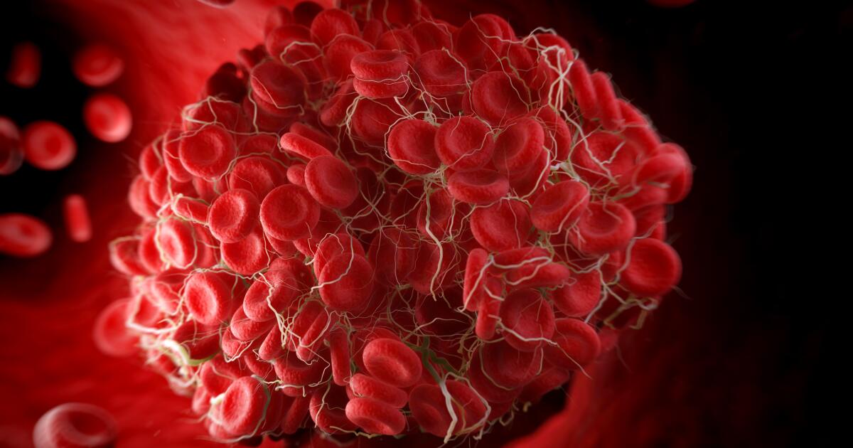 Types of Blood Clots and What They Mean