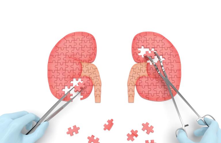 Chronic Kidney Disease Frequently Asked Questions