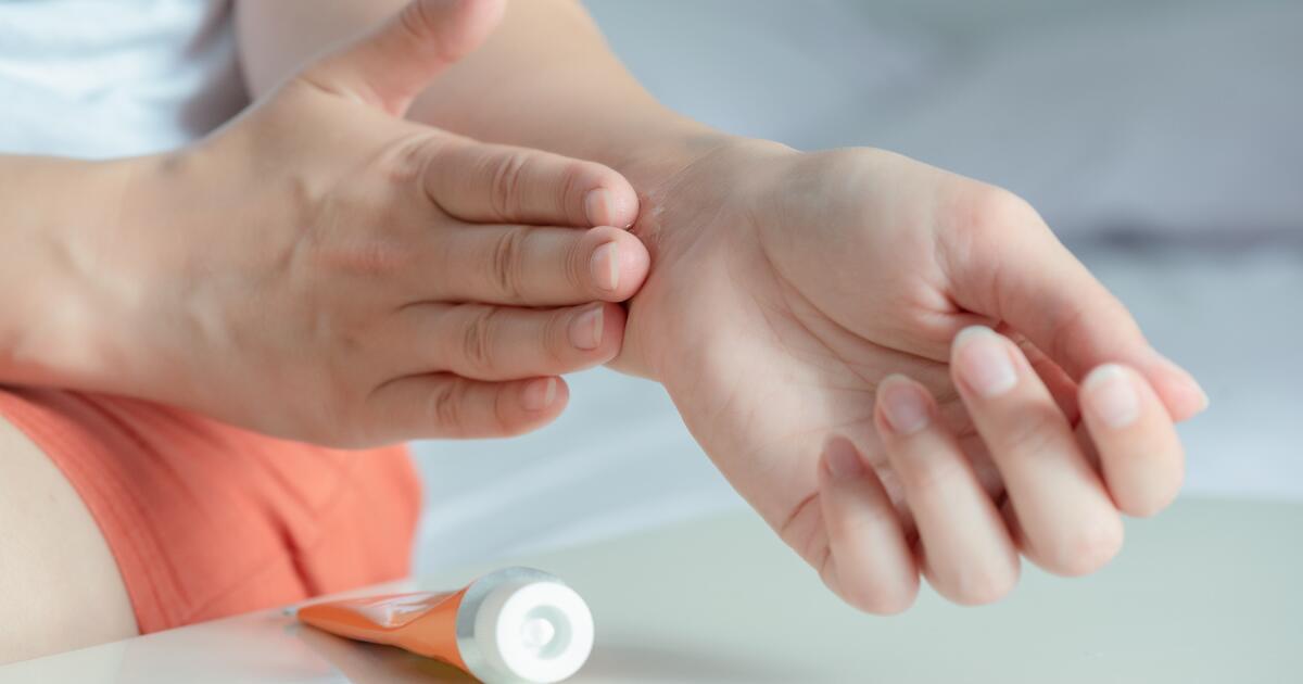 Voltaren Gel What It Treats How It Works Tiny little bumps on the forehead. voltaren gel what it treats how it works