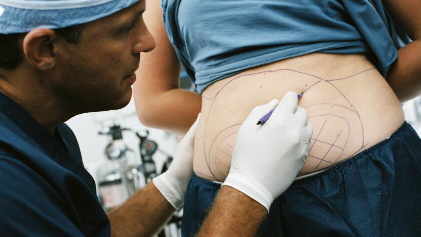 Female patient being readied procedure