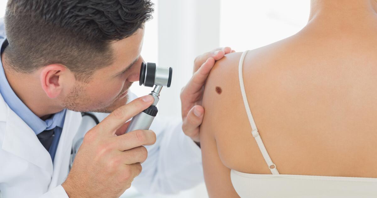 skin cancer check turramurra