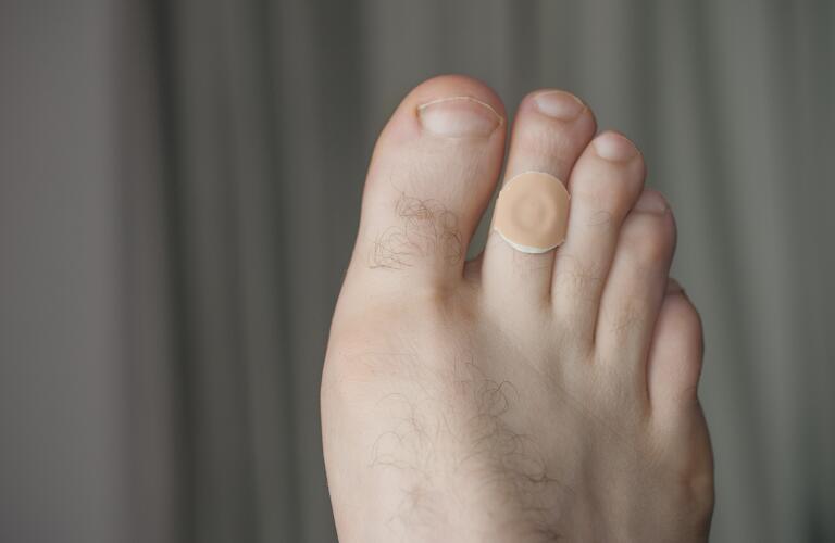 How To Treat Corns How To Get Rid Of Corns And Calluses