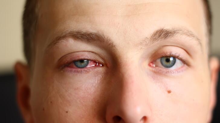 8 Common Eye Symptoms And What They Mean 8 Common Eye Symptoms And What They Mean