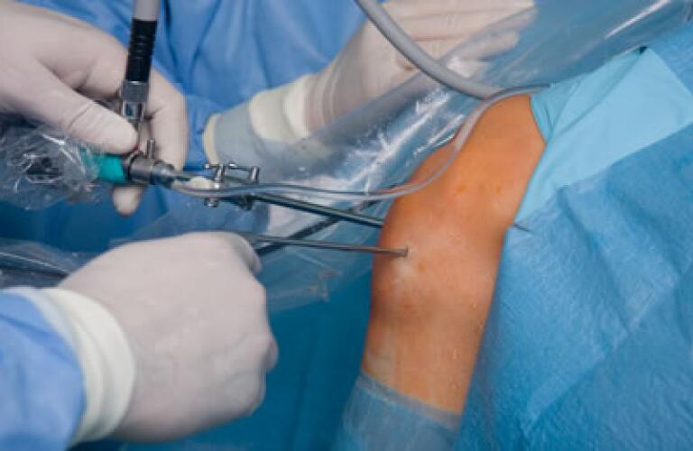 Arthroscopy - Joint Examination