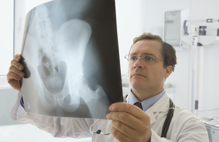 hip-joint-x-ray-examined-by-doctor