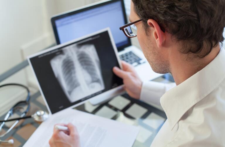 doctor-reviewing-x-ray-of-lungs