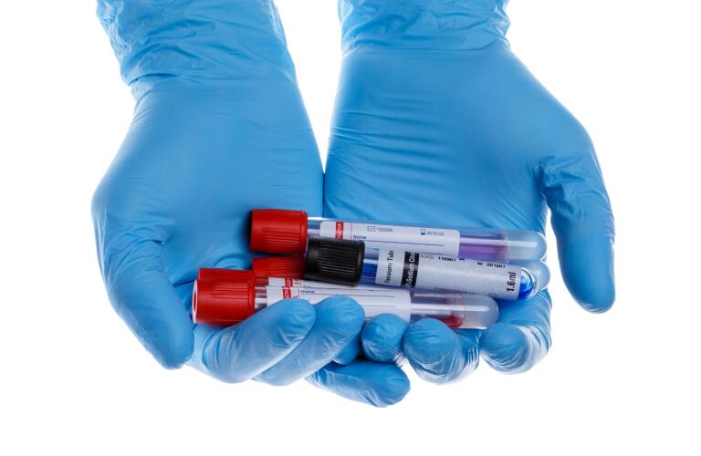 gloved-hand-holding-test-tubes