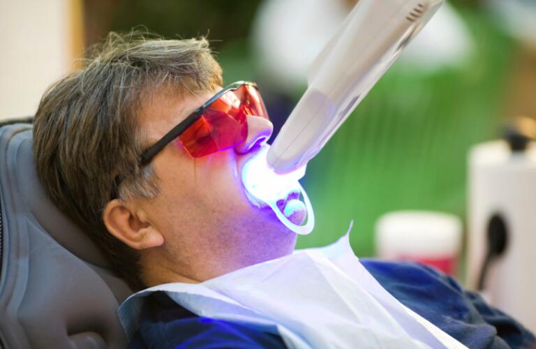 UV teeth whitening