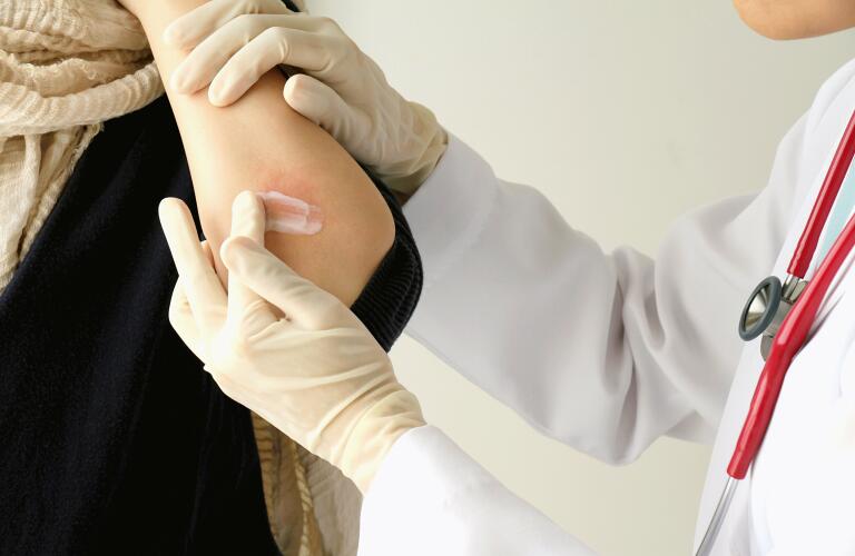 Psoriasis Eczema Dermatitis What S The Difference