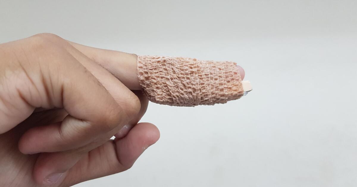 Mallet Finger Treatments What To Do For Mallet Finger