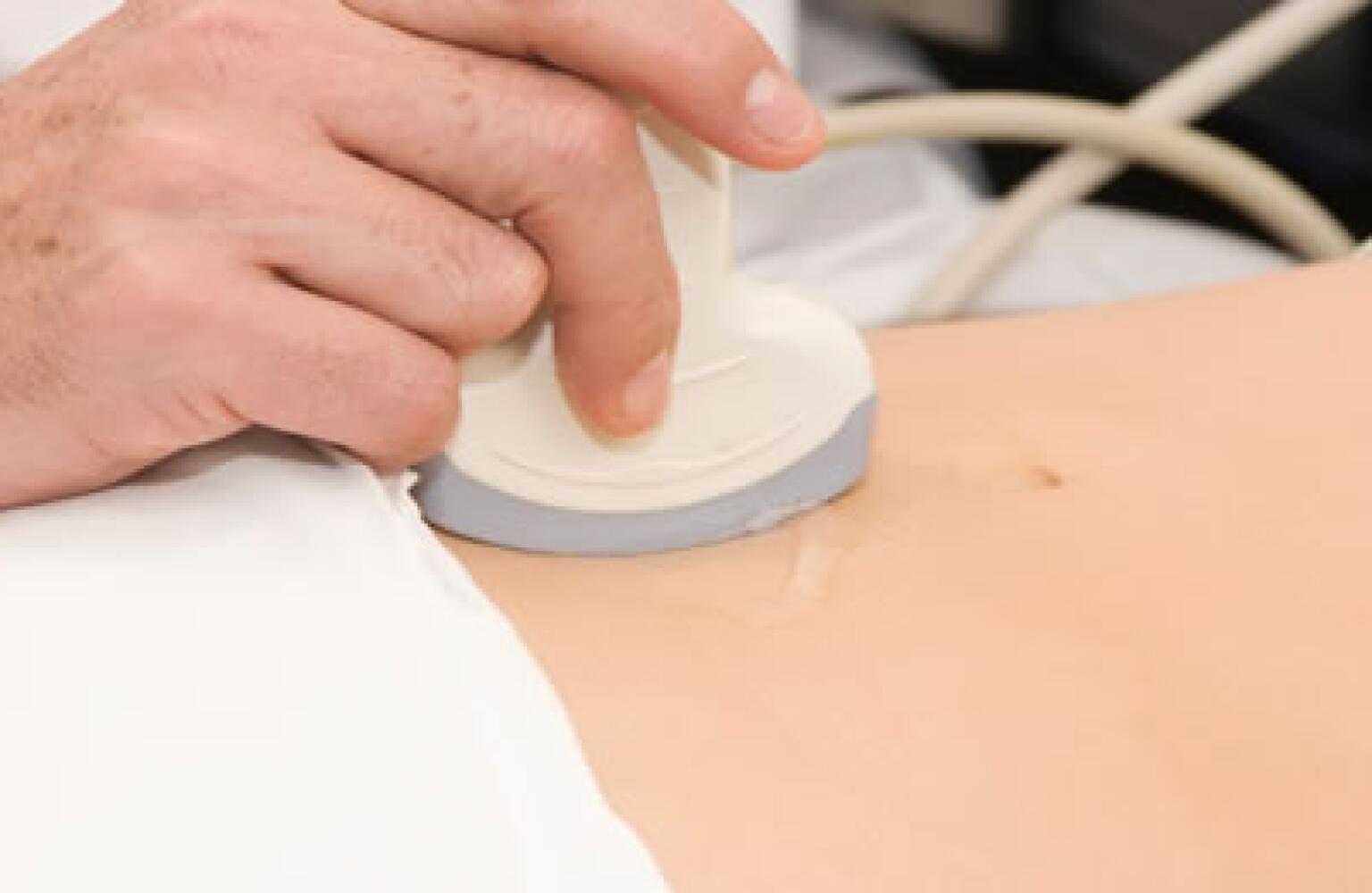 sonogram abdomen sonogram abdomen