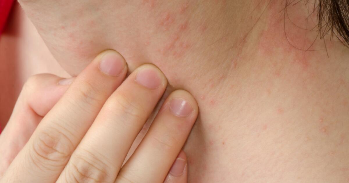Red Spots Symptoms Causes Treatments