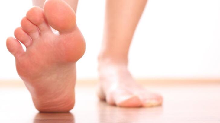 picture What Does Athlete's Foot Look Like Pictures 9 things to know about athlete s foot