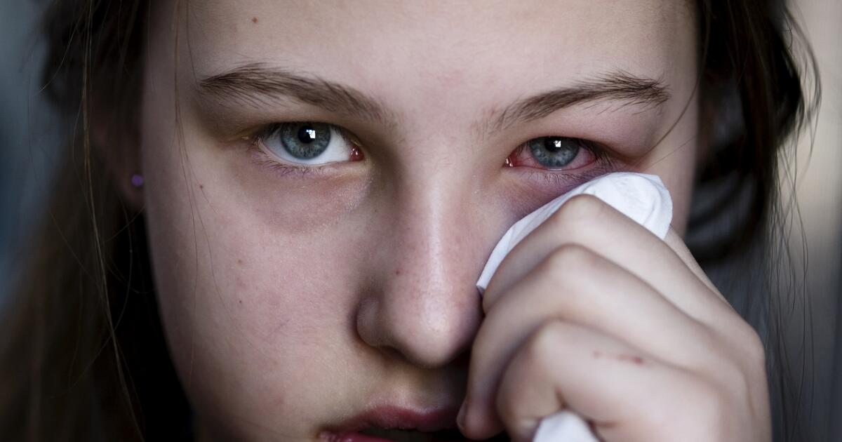 Eye Bleeding Symptoms Causes Treatments