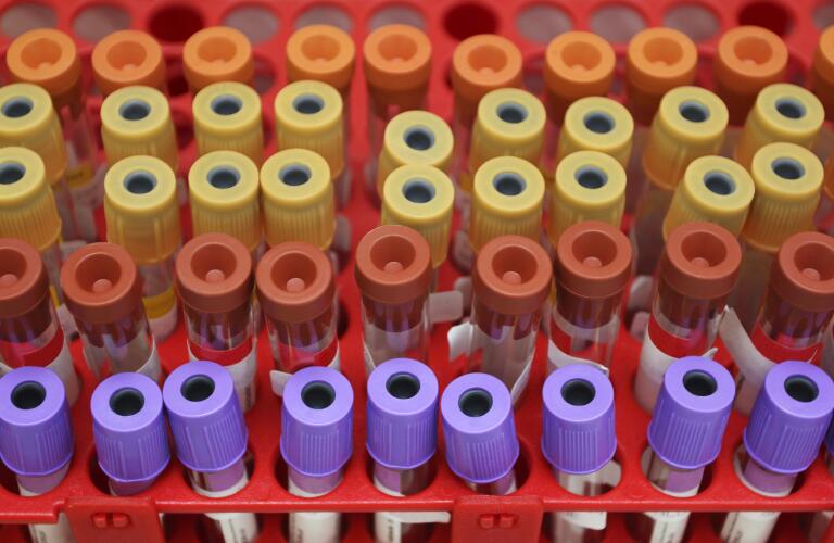 Top view of assorted blood sample tubes