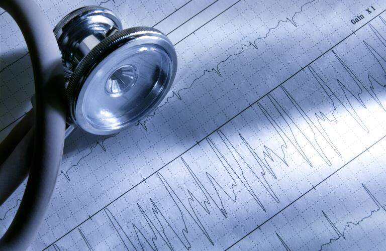 Stethoscope-on-EKG-results