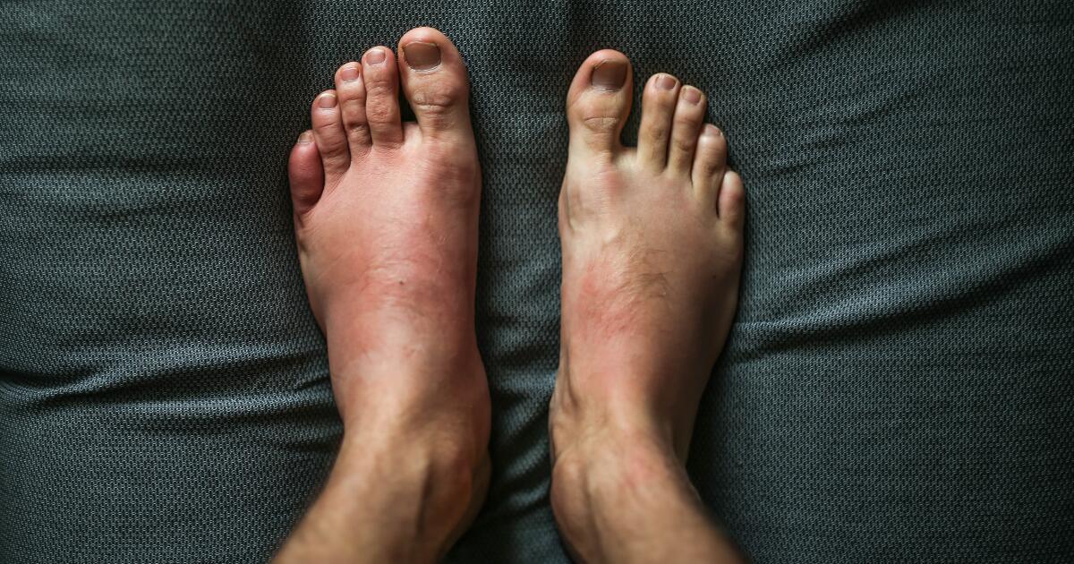 Leg Rash Symptoms Causes Treatments