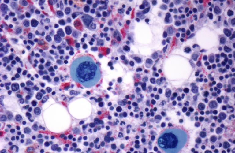 bone-marrow