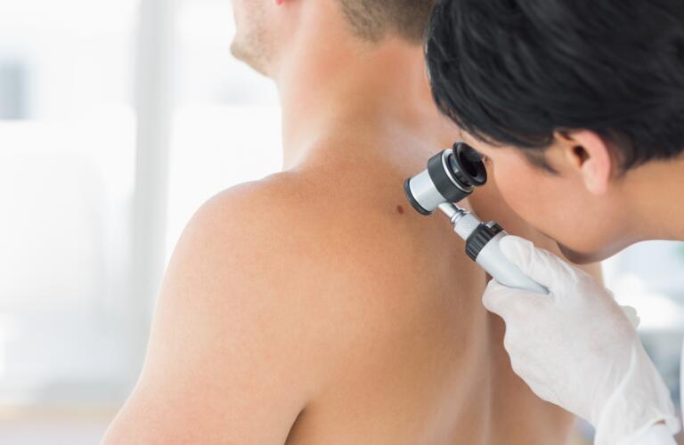 Doctor examining mole on back of man