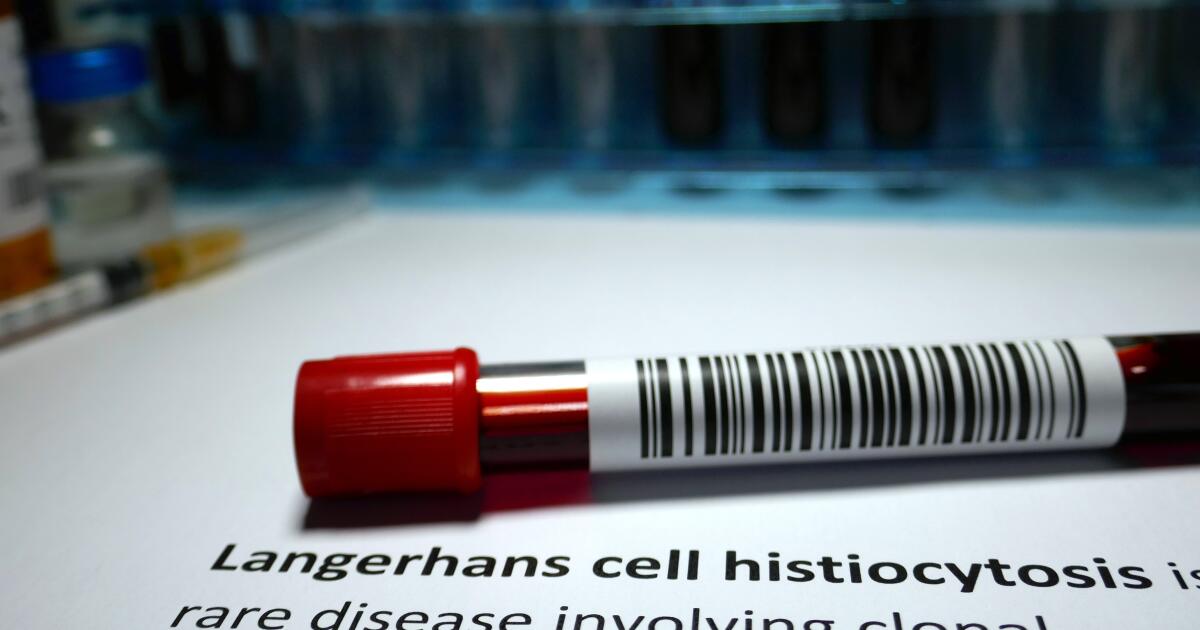 Letterer Siwe Disease Symptoms Treatment Langerhans Cell Histiocytosis