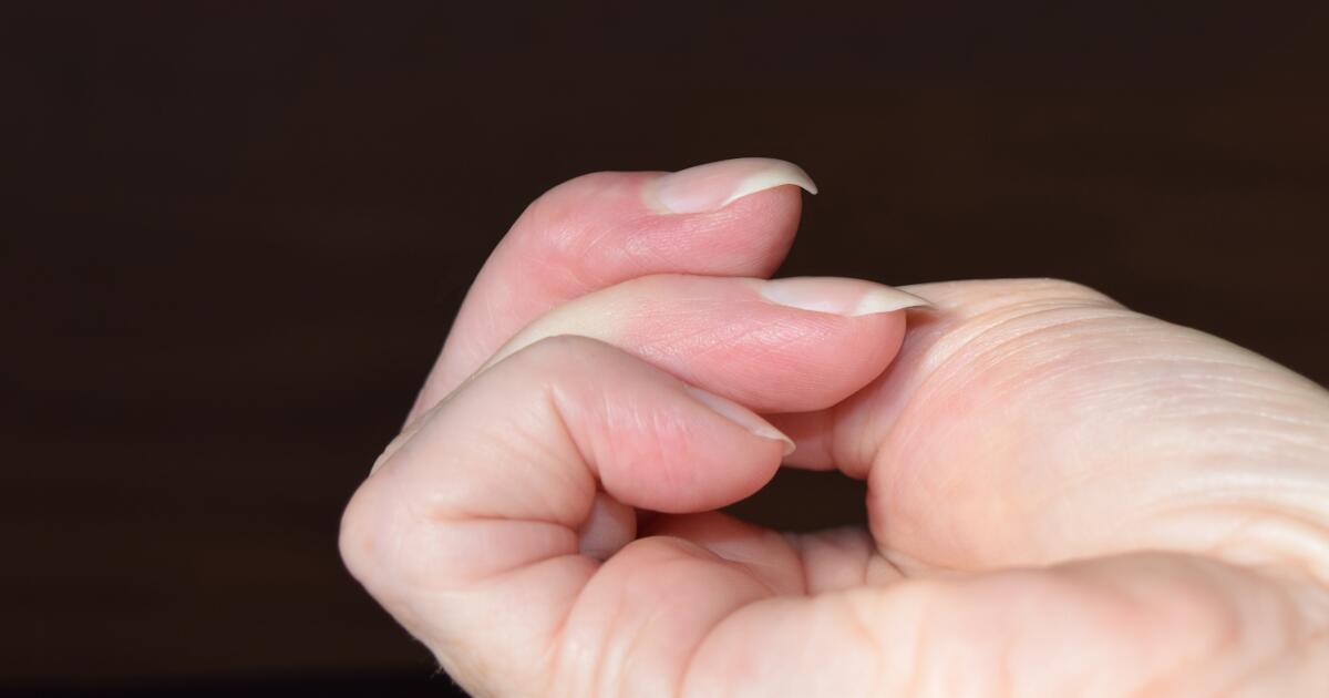 Finger Clubbing Symptoms Causes Treatments