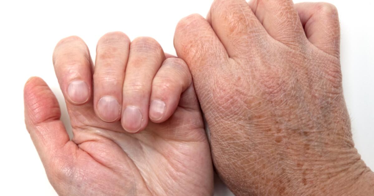 Thumb Pain Symptoms Causes Treatments Thumb Pain Symptoms Causes Treatments