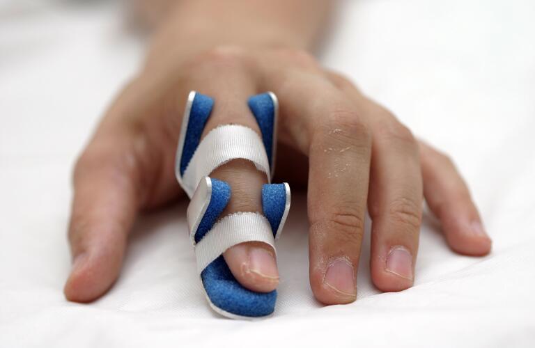 Broken Finger Recovery Treating a Broken Finger