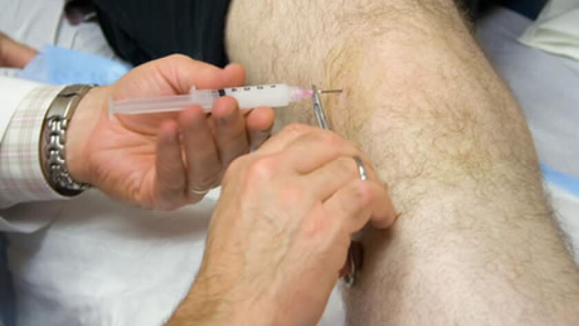 Arthrocentesis