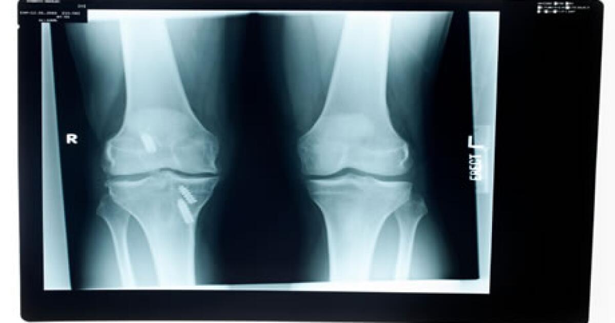 Acl Surgery Acl Reconstruction Procedure Details Risks Recovery Acl Surgery Acl Reconstruction Procedure Details Risks Recovery