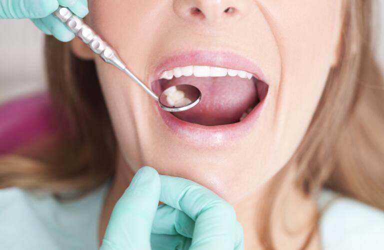 Dental exam