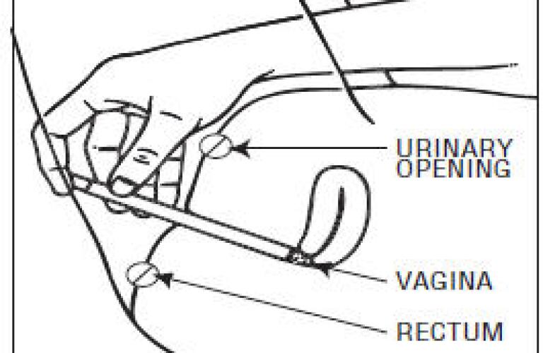 Terconazole Pictures, Images, Labels | Healthgrades | (cream) Terconazole Pictures, Images, Labels | Healthgrades | (cream)