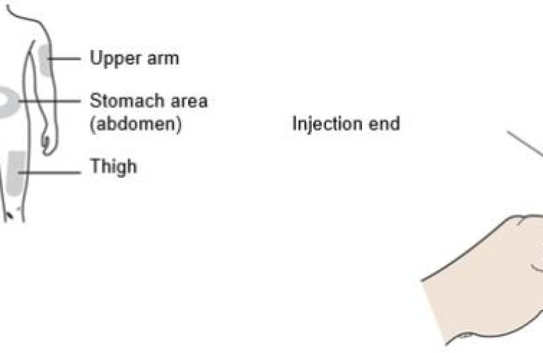 Enbrel Healthgrades Etanercept Solution
