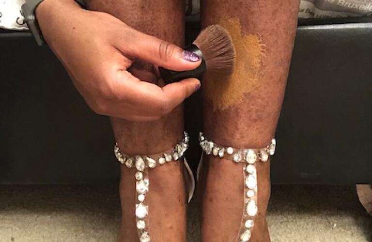 To Cover Up or Go Bare The Big Debate Behind Psoriasis and Body Makeup
